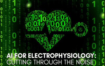 AI for Electrophysiology: Cutting through the noise